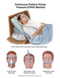 CPAP -BIPAP